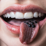 Black Dots On Tongue Explained