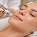 Microneedling Near Me